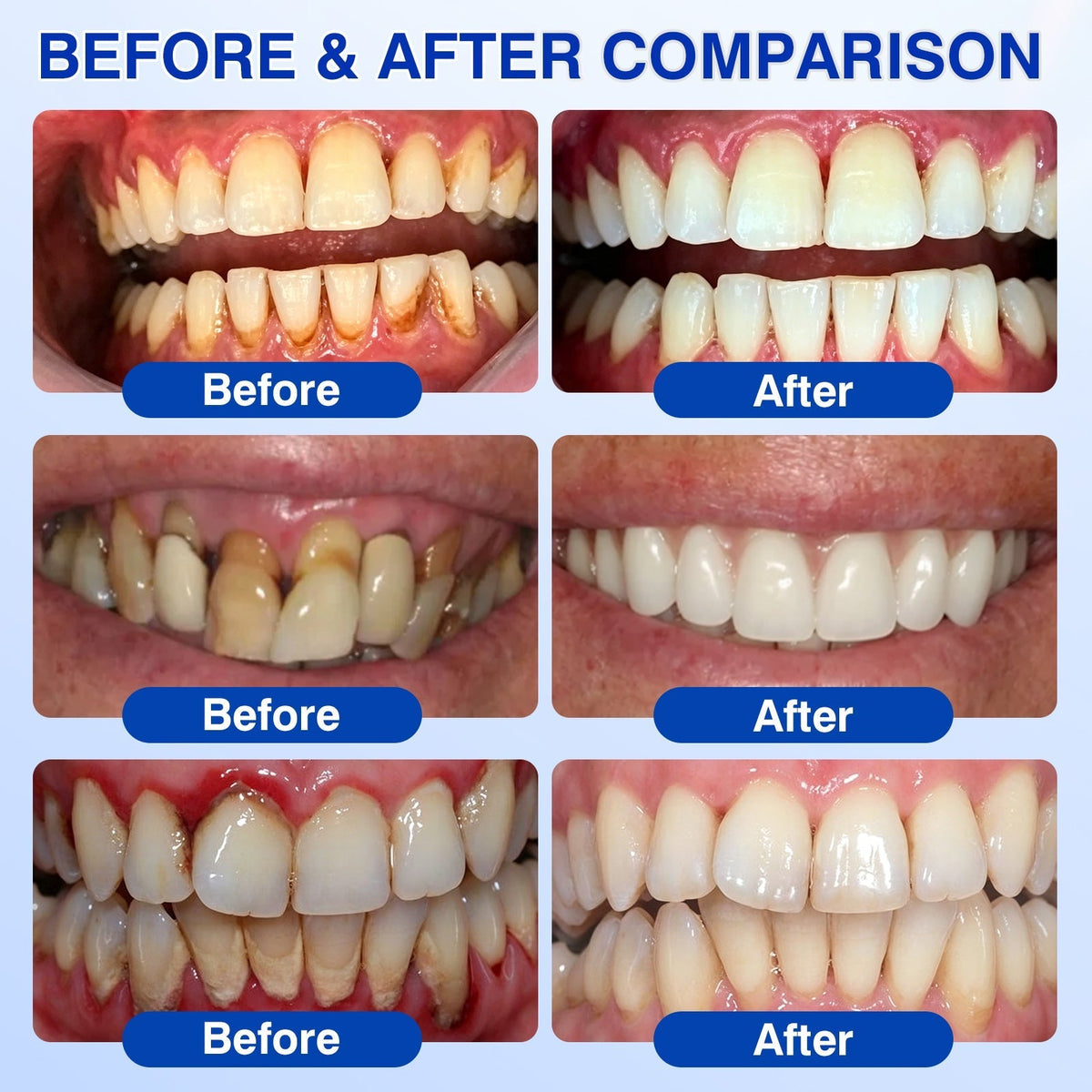 🇨🇦👩‍⚕️🦷👍 CureVivo® GumRevive Professional Gum Support Gel 👍