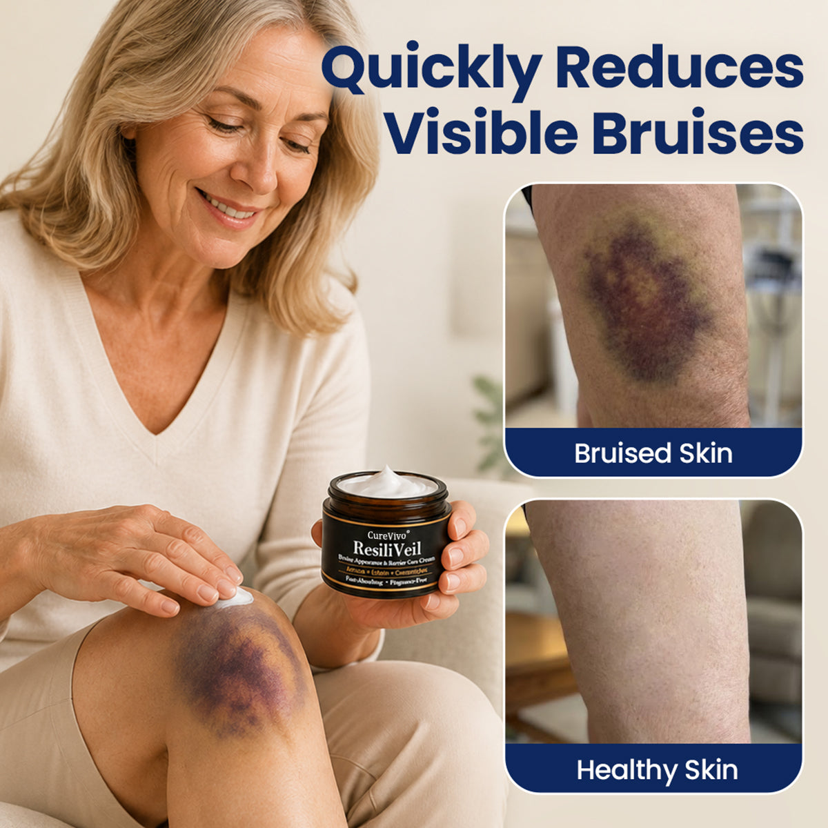 CureVivo® ResiliVeil Bruise Appearance Barrier Care Cream🔥👍